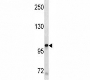 KIT antibody western blot analysis in A549 lysate. Observed molecular weight: ~120/145kDa (precusor/mature).