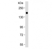 Western blot testing of mouse brain lysate with LRRK2 antibody.
