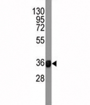 Western blot testing of FGFR4 antibody and human recombinant protein (42KD fragment).