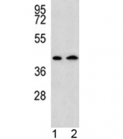AADAT antibody western blot analysis in human 1) HepG2, and 2) Y79 lysate. Predicted molecular weight: ~47 kDa.