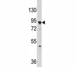 Western blot analysis of Dnmt3A antibody and Jurkat lysate. Predicted molecular weight: 100-130 kDa~