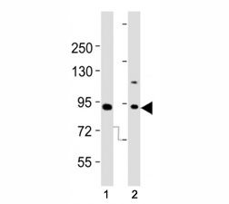 Western blot testing of Dnmt3b antibody at 1:2000 dilution. Lane 1: A431 lysate; 2: A549; Predicted molecular weight: 95 kDa.