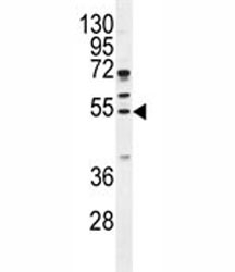 Cyclin B1 antibody western blot analysis in MDA-MB435 lysate. Predicted molecular weight: 48-60 kDa