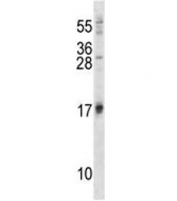 ISG15 antibody western blot analysis in 293 lysate. Expected molecular weight: 15-17 kDa.