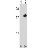 Western blot analysis of ISG15 antibody and 293 cell lysate (2 ug/lane) either nontransfected (Lane 1) or transiently transfected (2) with the ISG15 gene. Expected molecular weight: 15-17 kDa.