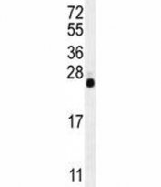 LIN28 antibody western blot analysis in mouse Neuro-2a lysate. Predicted molecular weight ~23 kDa.