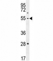 MMP1 antibody western blot analysis in MDA-MB231 lysate. Expected/observed molecular weight ~54 kDa.
