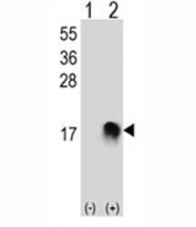 Western blot analysis of SUMO-2 antibody and 293 cell lysate (2 ug/lane) either nontransfected (Lane 1) or transiently transfected (2) with the SUMO2 gene.