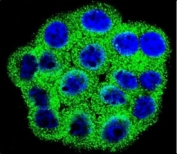 Confocal immunofluorescent analysis of CDKN2B antibody with HeLa cells followed by Alexa Fluor 488-conjugated goat anti-rabbit lgG (green). DAPI was used as a nuclear counterstain (blue).