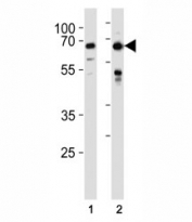 FOXO3 antibody western blot analysis in HeLa,MCF-7 lysate. Expected molecular weight: 71-90 kDa depending on glycosylation level.