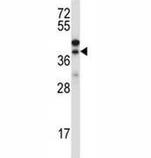 Western blot testing of CTGF antibody and NCI-H460 lysate~