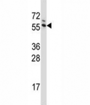 G3BP1 antibody western blot analysis in Jurkat lysate