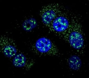 Confocal immunofluorescent analysis of MGMT antibody with MCF-7 cells followed by Alexa Fluor 488-conjugated goat anti-rabbit lgG (green). DAPI was used as a nuclear counterstain (blue).