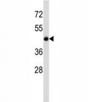BMP7 antibody western blot analysis in mouse heart tissue lysate. Predicted molecular weight: 49 kDa protein cleaved into ~33 and ~15 kDa segments.