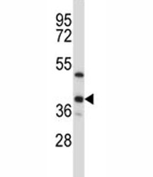 ERCC1 antibody western blot analysis in T47D lysate~