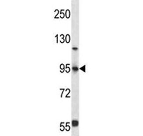 FOXP4 antibody western blot analysis in 293 lysate~