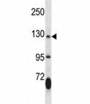 JAK2 antibody western blot analysis in mouse lung tissue lysate. Predicted molecular weight ~130 kDa