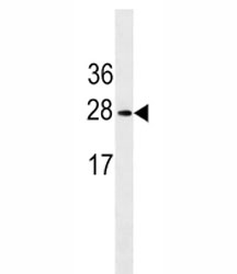 Erythropoietin antibody western blot analysis in K562 lysate. Predicted molecular weight: 18-34 kDa depending on glycosylation level.