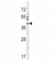 NKX6.1 antibody western blot analysis in A549 lysate
