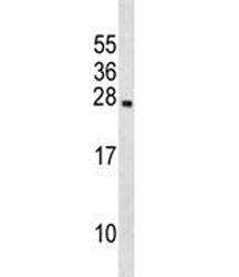 Prolactin antibody western blot analysis in 293 lysate.