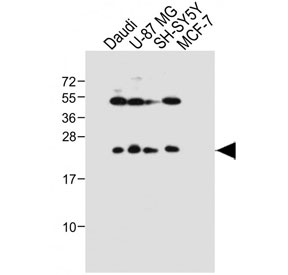 Western blot testing of human 1) Daudi, 2) U-87 MG, 3) SH-SY5Y and 4) MCF7 cell lysate with Prolactin antibody. Predicted molecular weight ~26 kDa.