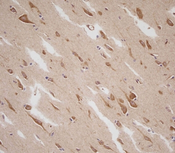 IHC staining of FFPE human brain with Prolactin antibody. HIER: boil tissue sections in pH6, 10mM citrate buffer, for 10-20 min and allow to cool before testing.
