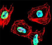Fluorescent confocal image of HeLa cell stained with HDAC antibody at 1:25. HDAC1 immunoreactivity is localized to the nucleus.