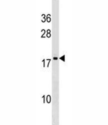 DR1 antibody western blot analysis in K562 lysate