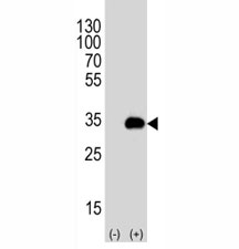Western blot analysis of ATG-5 antibody and 293T cell lysate either nontransfected (Lane 1) or transiently transfected (2) with the human gene. ATG5: ~32 kDA; ATG5/ATG12 heterodimer: ~56 kDa