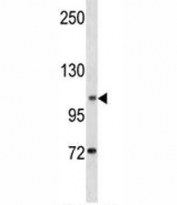 DOG1 antibody western blot analysis in human K562 lysate. Expected molecular weight 74-114 kDa but may be observed at higher molecular weights due to glycosylation.