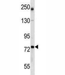 GCLC antibody western blot analysis in mouse bladder tissue lysate~