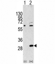 Western blot analysis of EIF4E2 antibody and 293 cell lysate either nontransfected (Lane 1) or transiently transfected with the EIF4E2 gene (2).
