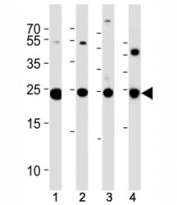 PGP 9.5 antibody western blot analysis in (1) U266, (2) NCI-H1299, (3) mouse Neuro-2a cell line and (4) mouse brain tissue lysate. Predicted molecular weight ~25 kDa.