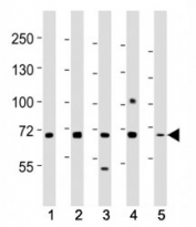 Western blot testing of MeCP2 antibody at 1:2000 dilution. Lane 1: SH-SY5Y lysate; 2: Jurkat; 3: A431; 4: HepG2; 5: NIH3T3; Observed molecular weight: ~55 kDa and ~75 kDa.