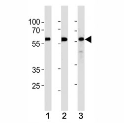 KLF4 antibody western blot analysis in (1) HeLa,(2) MCF-7 and (3) SW480 lysate. Predicted molecular weight: 50-60 kDa + ~75 kDa