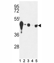 Western blot analysis of NSE antibody and (1) mouse cerebellum tissue and (2) Y79, (3) HepG2, (4) Jurkat and (5) CEM lysate. Predicted molecular weight: ~47 kDa.~