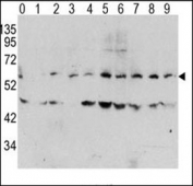Western blot analysis of phospho c-Myc antibody and human TPA activated HeLa cells/lysate (0: without TPA; 1: 60ug/ml TPA-15min; 2: 60ug/ml-30min; 3: 60ug/ml-45min; 4: 125ug/ml-15min; 5: 125ug/ml-30min; 6: 125ug/ml-45min; 7: 250ug/ml-15min; 8: 250ug/ml-30min; 9: 250ug/ml-45min)