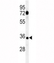 Western blot analysis of CD80 antibody and HL-60 lysate. Expected molecular weight: 34-75 kDa depending on the level of glycosylation.
