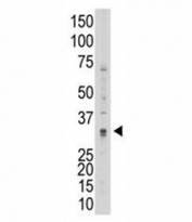 Western blot testing of MMP7 antibody and 293 cell lysate. Predicted molecular weight ~30kDa.