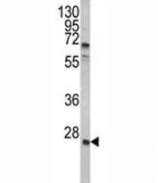 Western blot analysis of GRB2 antibody and A2058 lysate. Predicted molecular weight ~25kDa.