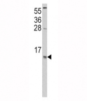 Western blot analysis of CCL2 antibody and HeLa lysate. Predicted molecular weight ~11/9kDa (precursor/mature).