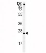 IGFBP4 antibody western blot analysis in mouse lung tissue lysate. Predicted molecular weight: ~28kDa.