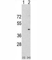 Western blot analysis of Aurora-A antibody and 293 cell lysate either nontransfected (Lane 1) or transiently transfected with the Aurora-A gene (2).