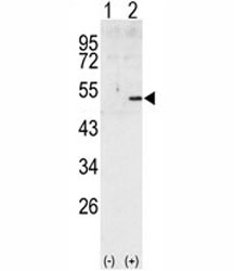 Western blot analysis of Cyclin A2 antibody and 293 cell lysate (2 ug/lane) either nontransfected (Lane 1) or transiently transfected with the human gene (2). Predicted molecular weight ~50 kDa~