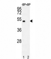 Western blot analysis of E2F1 antibody pre-incubated without (lane 1) and with (2) blocking peptide in 293T lysate. Predicted molecular weight: 48-70 kDa.