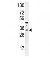 Western blot analysis of IGFBP3 antibody and HepG2 lysate. The glycoprotein is visualized between 31~44 kDa.