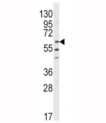 Western blot analysis of LYN antibody and HL-60 lysate.