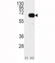 Western blot analysis of SMAD4 antibody and 293 cell lysate (2 ug/lane) either nontransfected (Lane 1) or transiently transfected with the human gene (2). Predicted molecular weight: 60-70 kDa.