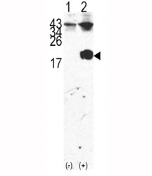 Western blot analysis of FKBP12 antibody and 293 cell lysate either nontransfected (Lane 1) or transiently transfected with the FKBP12 gene (2).
