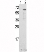 Western blot analysis of CAMKK1 antibody and 293 cell lysate either nontransfected (Lane 1) or transiently transfected with the CAMKK1 gene (2).